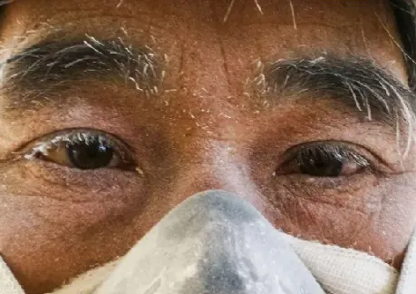 Close-up of a worker’s face above a dust mask, his eyebrows and eyelashes coated in white dust.